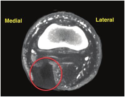 CONCLUSIONS Possible medial collateral ligament damage of the coffin joint Loss of visible vasculature in the distal portion of the foot Prognosis grave JANUARY 24, 2011 Presentation to Goal: Second