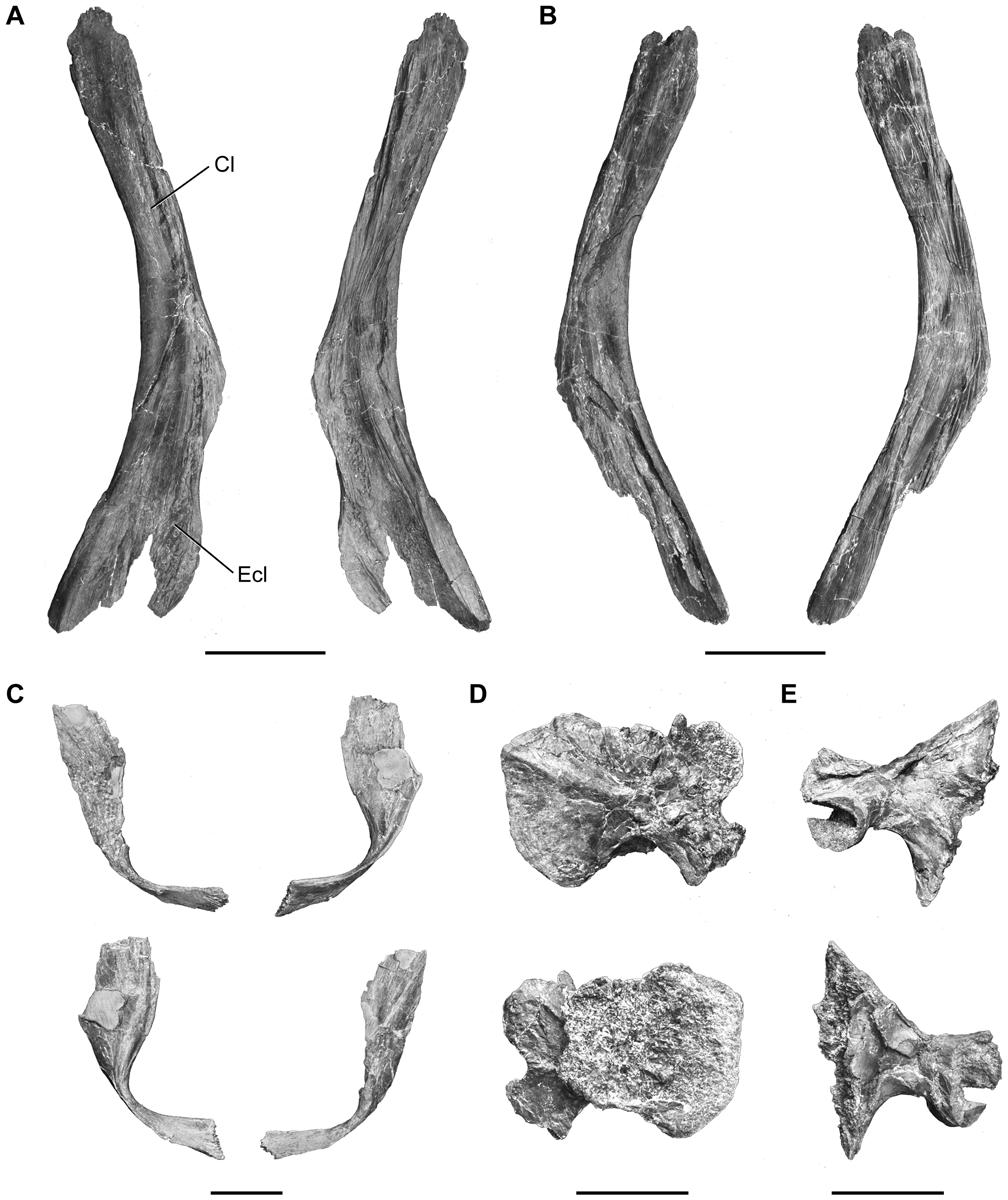 Figure 18. Megalocoelacanthus dobiei Schwimmer, Stewart & Williams, 1994, AMNH FF 20267 from lower Campanian of the Niobrara Formation. Shoulder girdle.