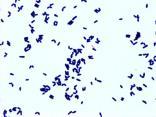 Gram Positive Rods Listeria Corynebacteria Diphtheroids Clostridium