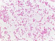 coli Klebsiella Salmonella Shigella Yersinia Proteus Pseudomonads P.