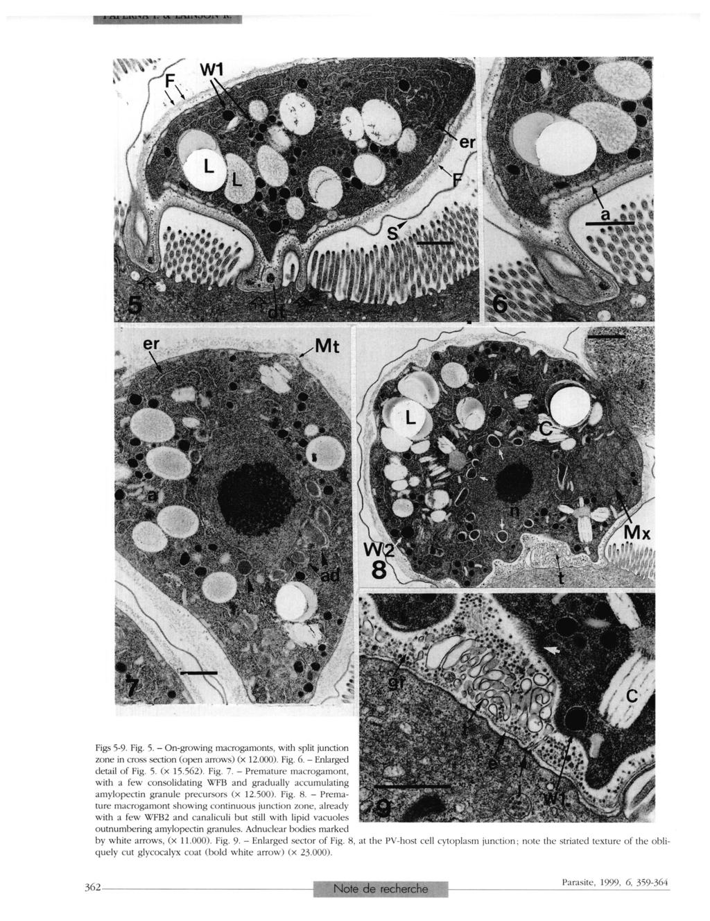 Figs 5-9. Fig. 5. - On-growing macrogamonts, with split junction zone in cross section (open arrows) (x 12.000). Fig. 6. - Enlarged detail of Fig. 5. (x 15.562). Fig. 7.
