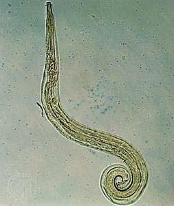 Enterobius vermicularis (Pinworm) Small nematode, a common parasite among children, it is unique in that eggs are viable