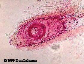 Trichinella spiralis Very small nematode about 3 mm x 40 μm, lives in small intestine of man, rat, and pig where fertilized female liberate hundred of larvae which circulate in blood stream to the