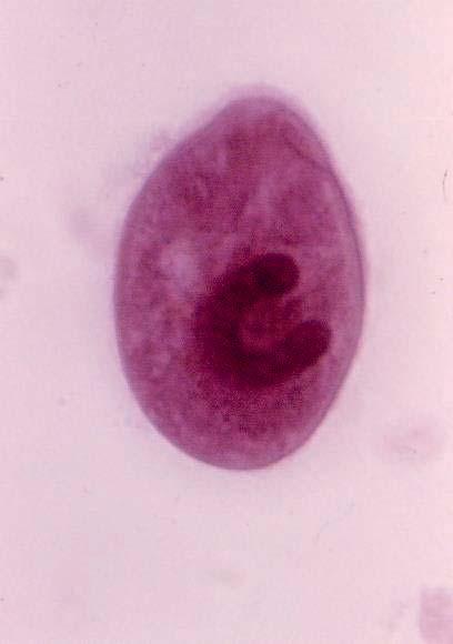Balantidium coli It causes balantidiasis or balantidial dysentery, is the largest intestinal protozoan of humans.