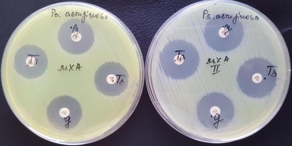 Pencheva DV et al, 2018, 5(1):145-152 When testing the same antimicrobial discs on plates with medium MHA II "BBL" lot 3084480 it was taken account of the change in the interpretation of two types of