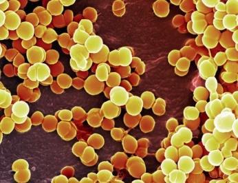 Combination therapy in ciai infections Colonized with MRSA or who are at risk of having an