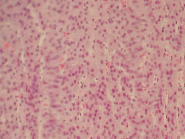 Jejunal lymph node Puppy 1 - all jejunal lymph nodes were found to be extremely congested with small lymphoid follicles and expanded interfollicular regions of