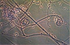 98 SLHZDN5 Figure 1. Microscopy of Trichophyton mentagrophytes. Courtesy of Dr. Michael R.