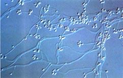 100 SLHZDN5 Figure 7. Microscopy of Sporothrix schenckii. Courtesy of Dr. Michael R.