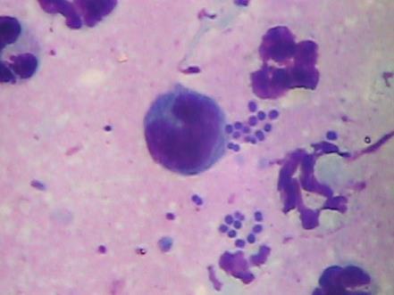 Cytology isn t always necessary (CVT XV, 437) but it is reassuring to find cocci, especially in their tidy grouping of two or four, plus or minus neutrophils and macrophages.
