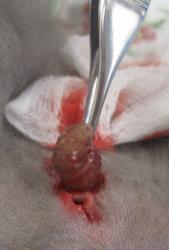 in one piece Recurrent abscesses = residual infection or remaining pieces Do not squeeze the lesion!