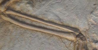 and a bowed, or bent, ulna (one of the lower arm bones).