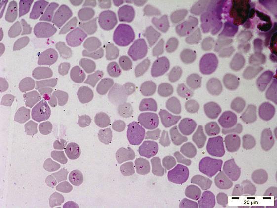 2 Case Reports in Veterinary Medicine Table 1: Haematobiochemical parameters in the dog infected with Babesia gibsoni.