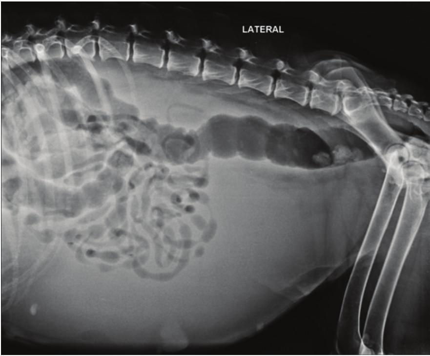 References Figure 3: USG of abdomen showing anechoic area indicating free flowing fluid in abdomen. case was thus confirmed as being ascites.