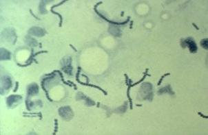 Streptococcus uberis The classic environmental bacterium Lives on the skin of some cows.