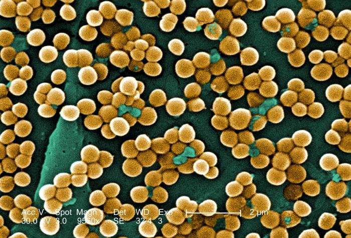 Staphylococcus aureus lives inside udders or on teat skin does not survive for long in the environment spread by passing infected milk from cow