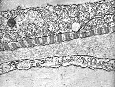 Body composed of epidermis, mesoglea, & gastrodermis Considered plankton Limited locomotion Contraction