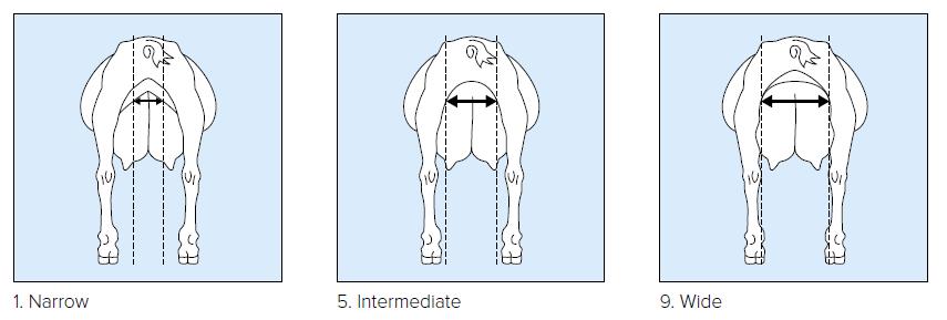 1 - Convex to flat floor (flat), broken ligament 9 - Deep cleft/strong