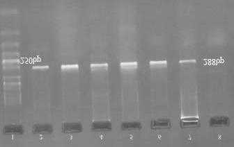 2x Master Mix (Amiplicon III, Viragen, Mgcl2 2.0 mm), 25 pmol each of primers CHS1 1S and CHS1 1R (TAG Copenhagen A/S), and 5 μl of DNA template.