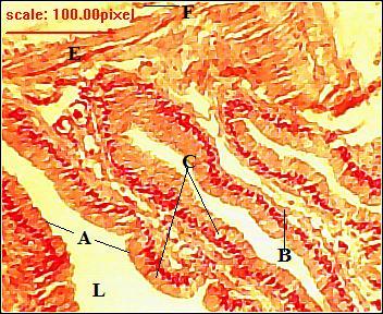 Plate 5: Photomicrograph of the transverse section of the esophagus showing; Ciliated Columnar Epithelium (A), muscularis