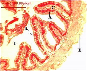 epithelium (A), goblet cells (B), lymphatic nodules (C), submucosa (D), tunica muscularis (E), serosal layer (F) and