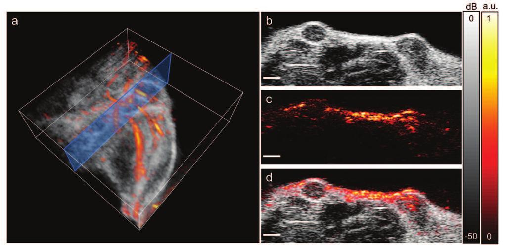 Fig. 5. In vivo anatomical photoacoustic and ultrasound images. (a) 3D overlay of photoacoustic and ultrasound images of the upper leg/abdominal region. Blue box shows the 2D imaging plane of (b-d).