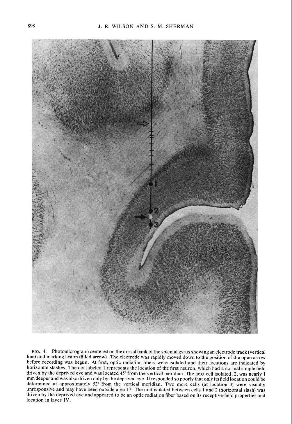 898 J. R. WILSON AND S. M. SHERMAN FIG. 4. Photomicrograph centered on the dorsal bank of the splenial gyrus showing an electrode track (vertical line) and marking lesion (filled arrow).