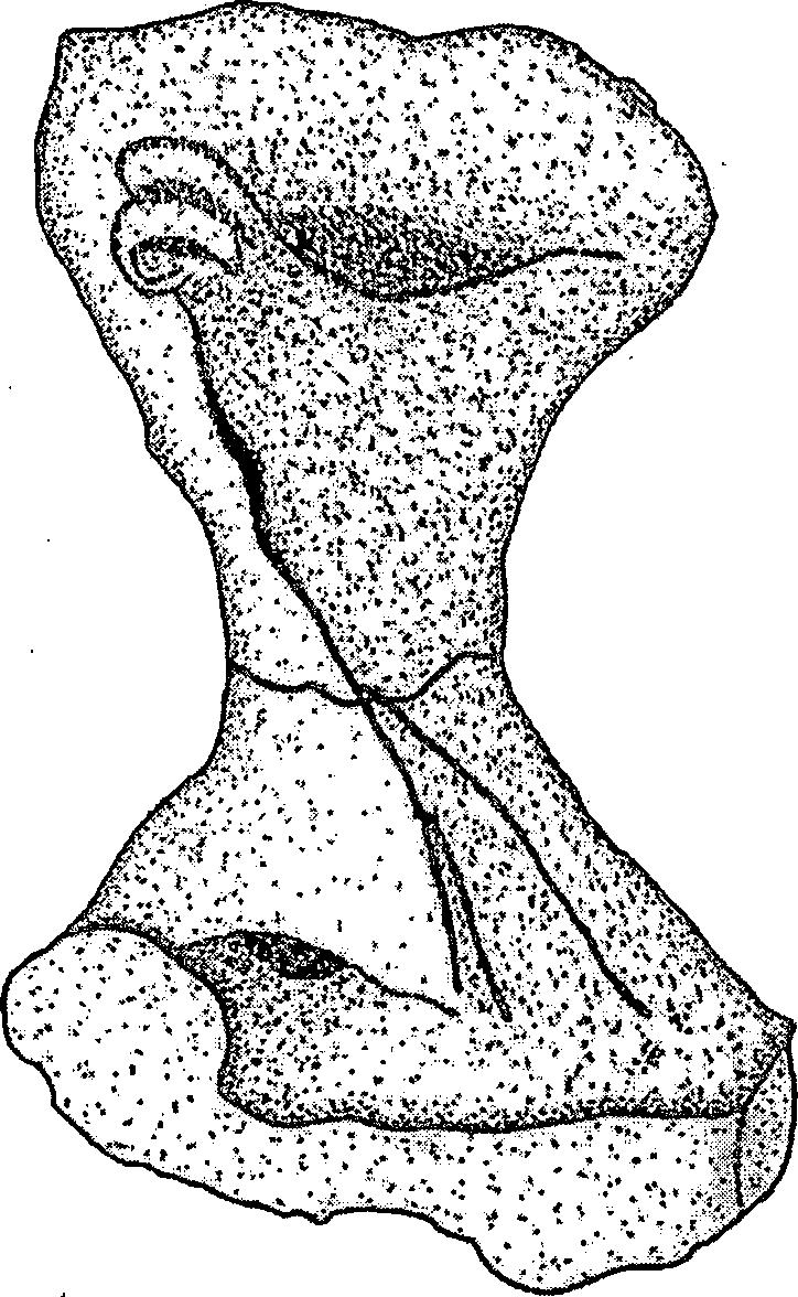1 cm Figure 17. Right Femur of Limnosceloides brachycoles, University of California Museum of Paleontology 35767, in Ventral View. description suggests that the adductor ridge of L.