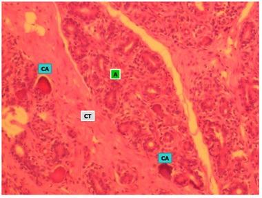 Histology of Mammary Gland During Lactating and. 995 [6] Heinz, M., Michel, G. (1991). Morphology of the bovine mammary gland during the dry period with reference to the involution process. 2.