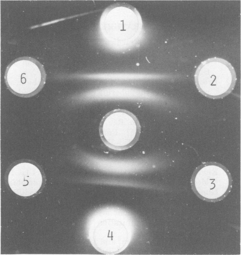 VOL. 5, 1977 TABLE 1. IMMUNOLOGICAL IDENTIFICATION OF C. IMMITIS Accuracy evaluation of the immunological procedure for identifying Coccidioides immitis cultures with 166 unknown fungus isolates No.