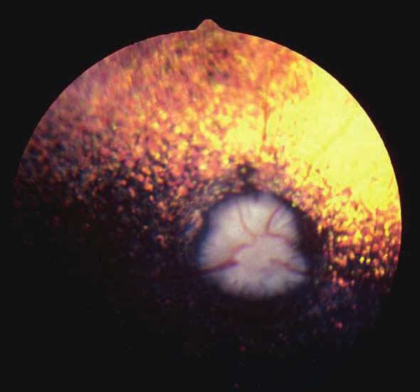 47 48 49 47: Generalised progressive retinal atrophy in a Cocker Spaniel.