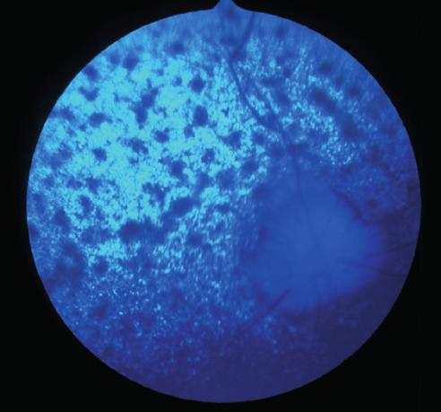 50 51 52 50: Retinal pigment epithelial dystrophy in a Cocker Spaniel.