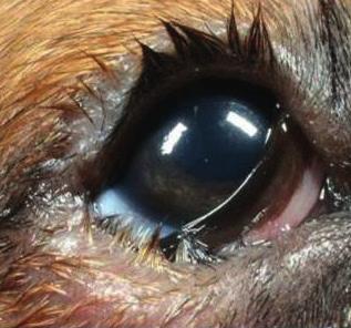 anteriorly to the cornea where a discrete opacity is present at the