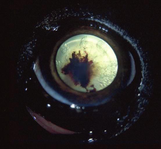 23: Persistent hyperplastic primary vitreous. In this dog, the hyaloid vessel has remained patent and there is haemorrhage into the lens.
