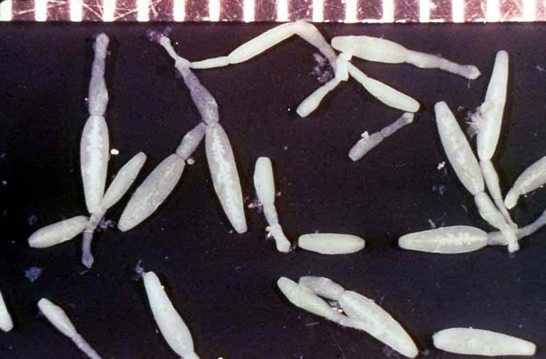 Plate 3. Echinococcus granulosus.