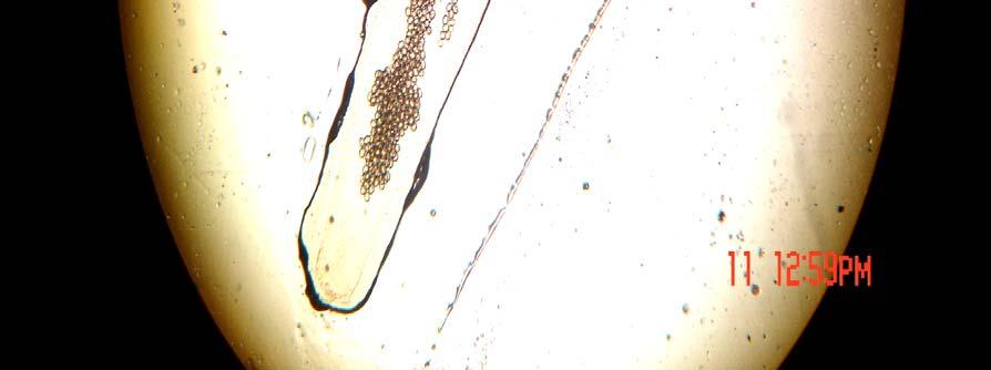 , granulosus worm
