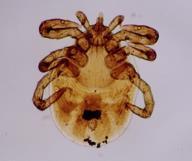 Trypanosoma evansi Theileria