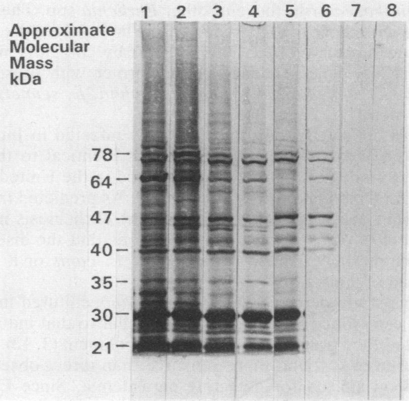 VOL. 30, 1992 ELISA AND WESTERN BLOT ANALYSES OF E. CANIS 147 TABLE 1. ELISA and IFA results for IgG antibodies to E.