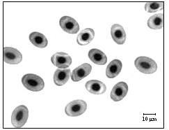 h. hermanni was smaller than that of E. orbicularis hellenica, but larger than that of M. rivulata and T. 10 µ 10 µ Fig. 2. Erythrocyte and nuclear sizes of Emys orbicularis hellenica. Fig. 4.