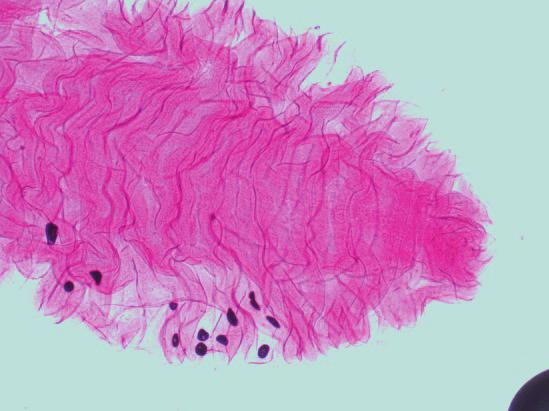 In microscopy using clearing with Glycerin and staining Carmine, the anterior side looks larger and on its anterior end formations look like a mouth.