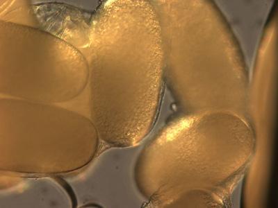 Microscopic Exam Eggs were roughly 600 µm long and lacked