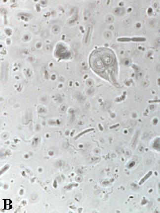 nuclei (arrows). Giardia trophozoite - direct smear.