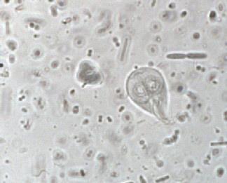 planes of the same trophozoite surrounded by bacteria and
