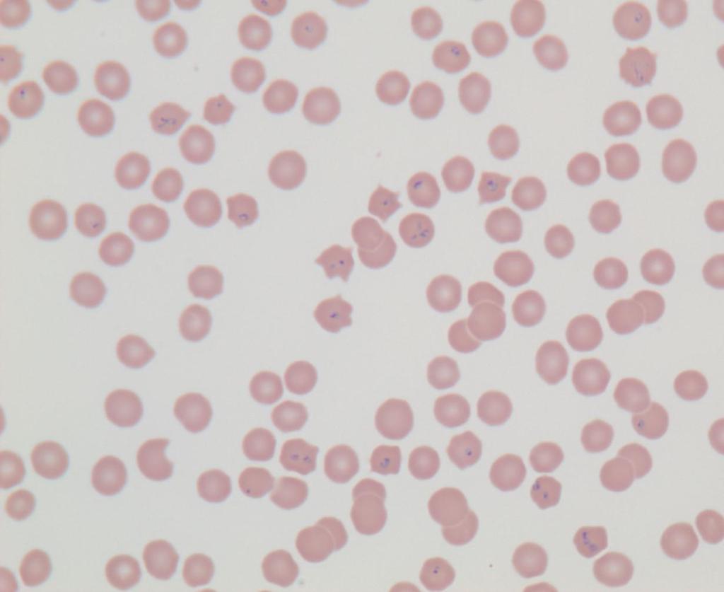 C A D B Figure 1.2: Blood smear from infected cat. Various forms of C.