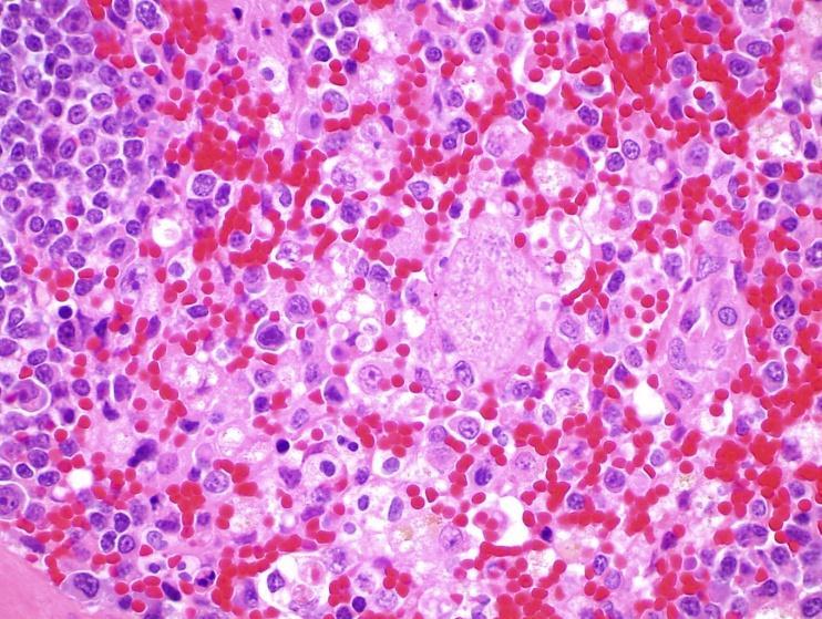 Figure 1.3: Macrophage containing large numbers of schizonts within the splenic vasculature (arrow). Splenic congestion is also present. Photomicrograph at 60X. Photo courtesy of Dr. Kei Kuroki.