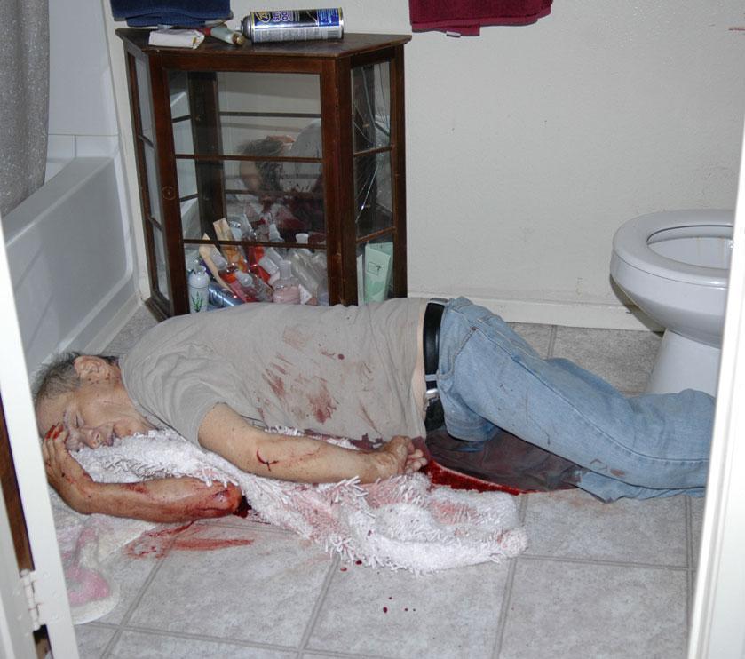 FIGURE 11.3 This man was found to have died from multiple sharp force injuries in a bathroom. Additionally, his jeans were unzipped, there was unflushed urine in the toilet, Figure and there 1.