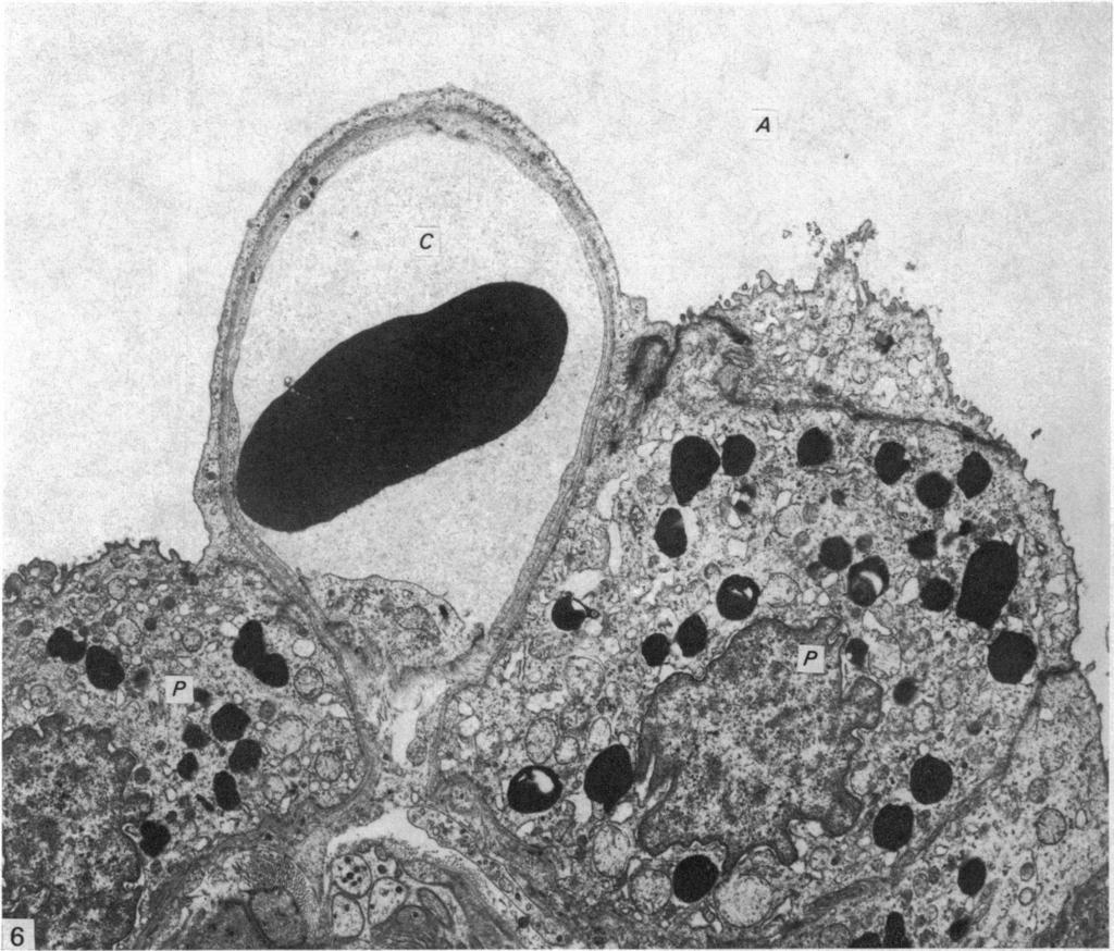 Note the Z-shaped profile of the intercellular gap.