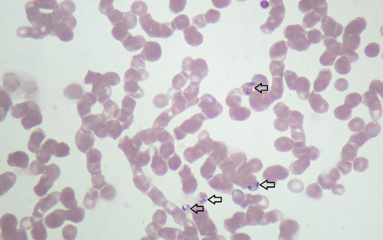 Acta Veterinaria-Beograd 2018, 68 (2), 127-160 be improved by examining buffy coat smears or smears made from capillary blood [15,160]. Figure 1 is showing B.