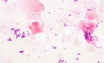 Gram positive cocci in clusters 1.