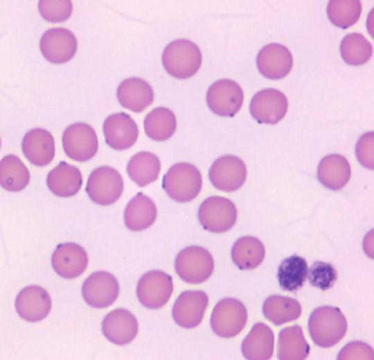 Organisms are seen as dark purple-blue dots on the surface of red blood cells.